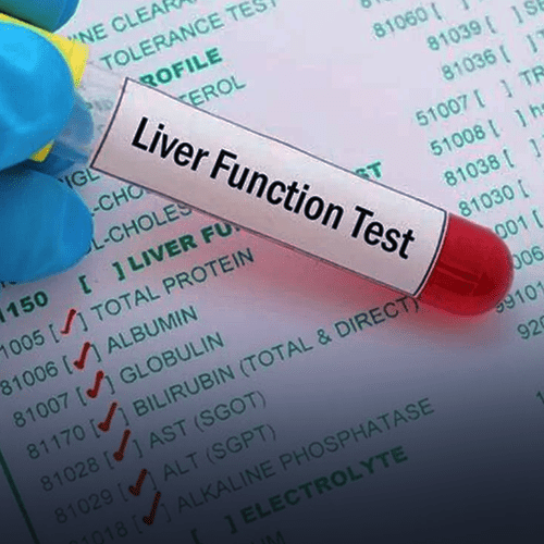 Liver and kidney function tests