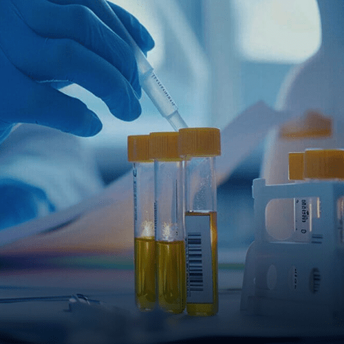 Urinalysis