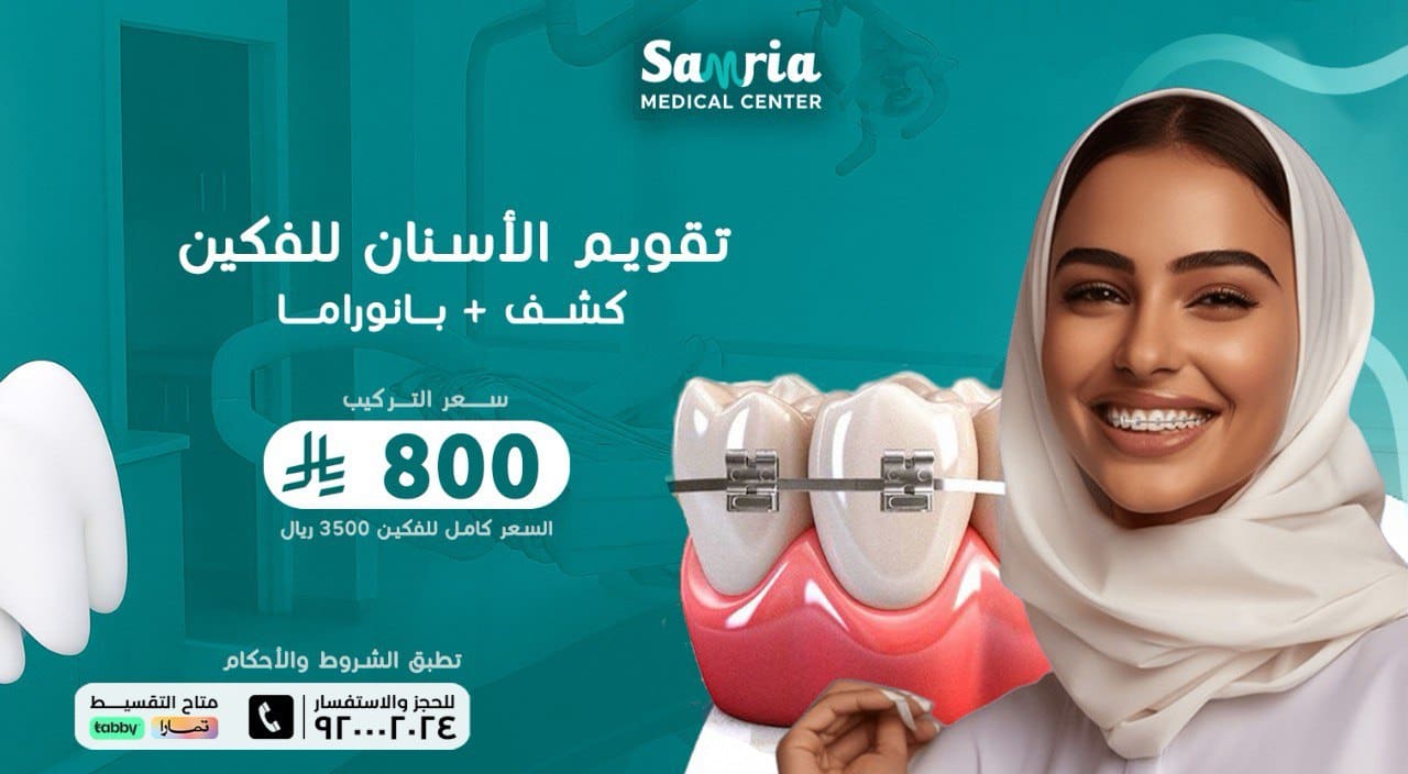 عروض الاسنان