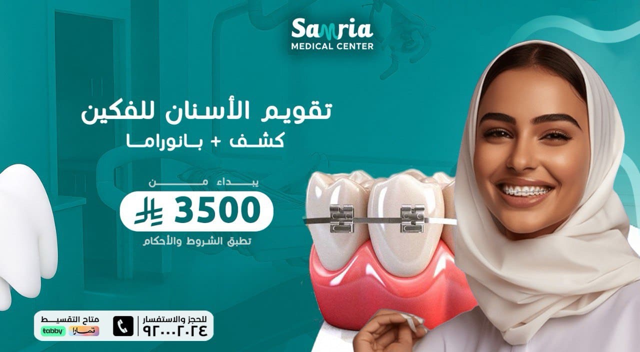 عروض الاسنان