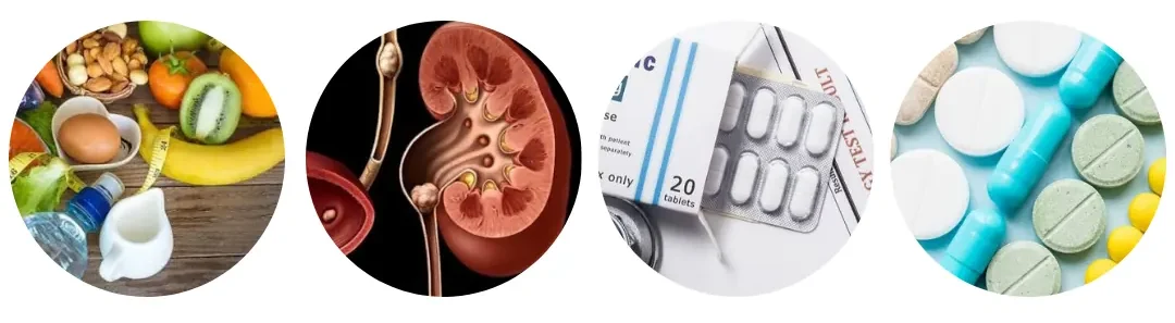 kidney stones treatment methods 