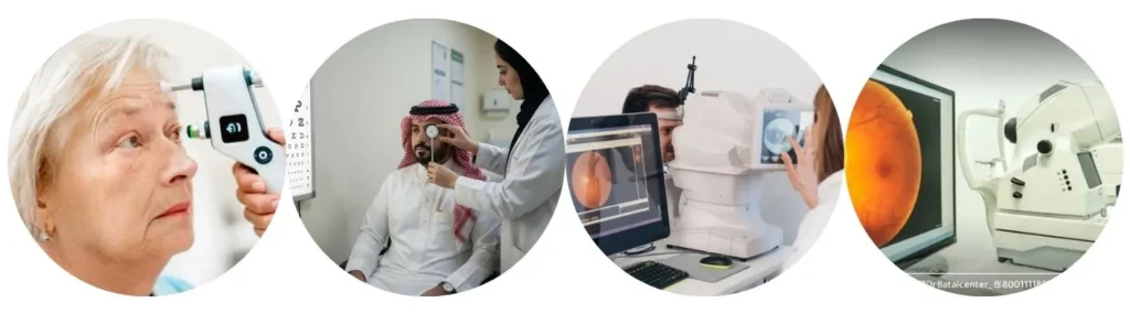 فحص العيون و النظر.