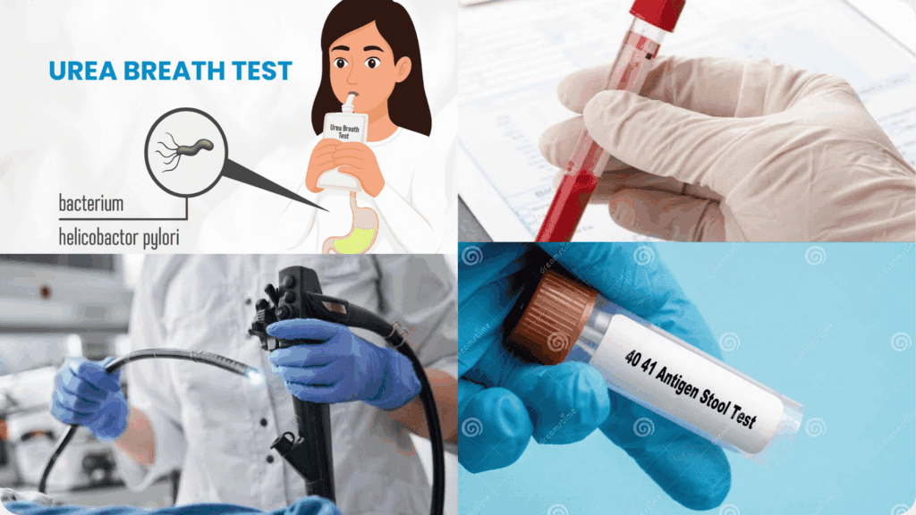 H. Pylori diagnostic testing methods including urea breath test, stool antigen, endoscopy, and blood test at Al Samria Medical Center Jeddah 